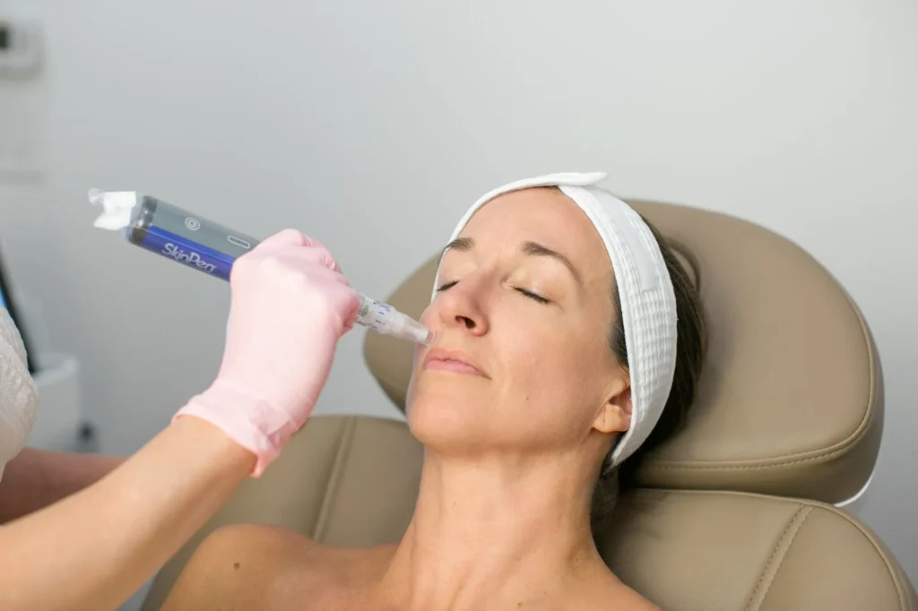 Best Types of Microneedling Treatment in Charleston, SC